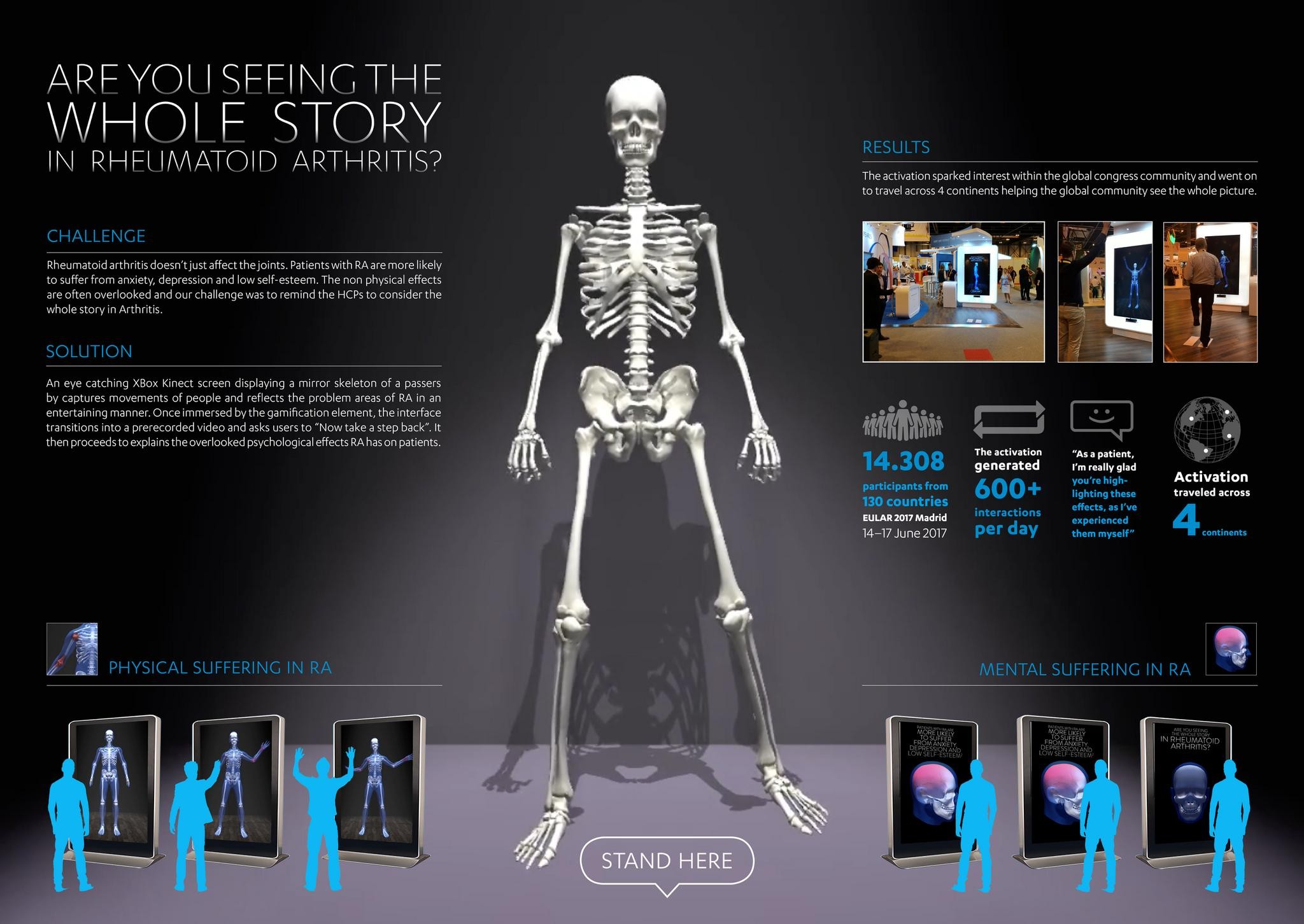 Skeleton Kinetic - See the whole Story in RA