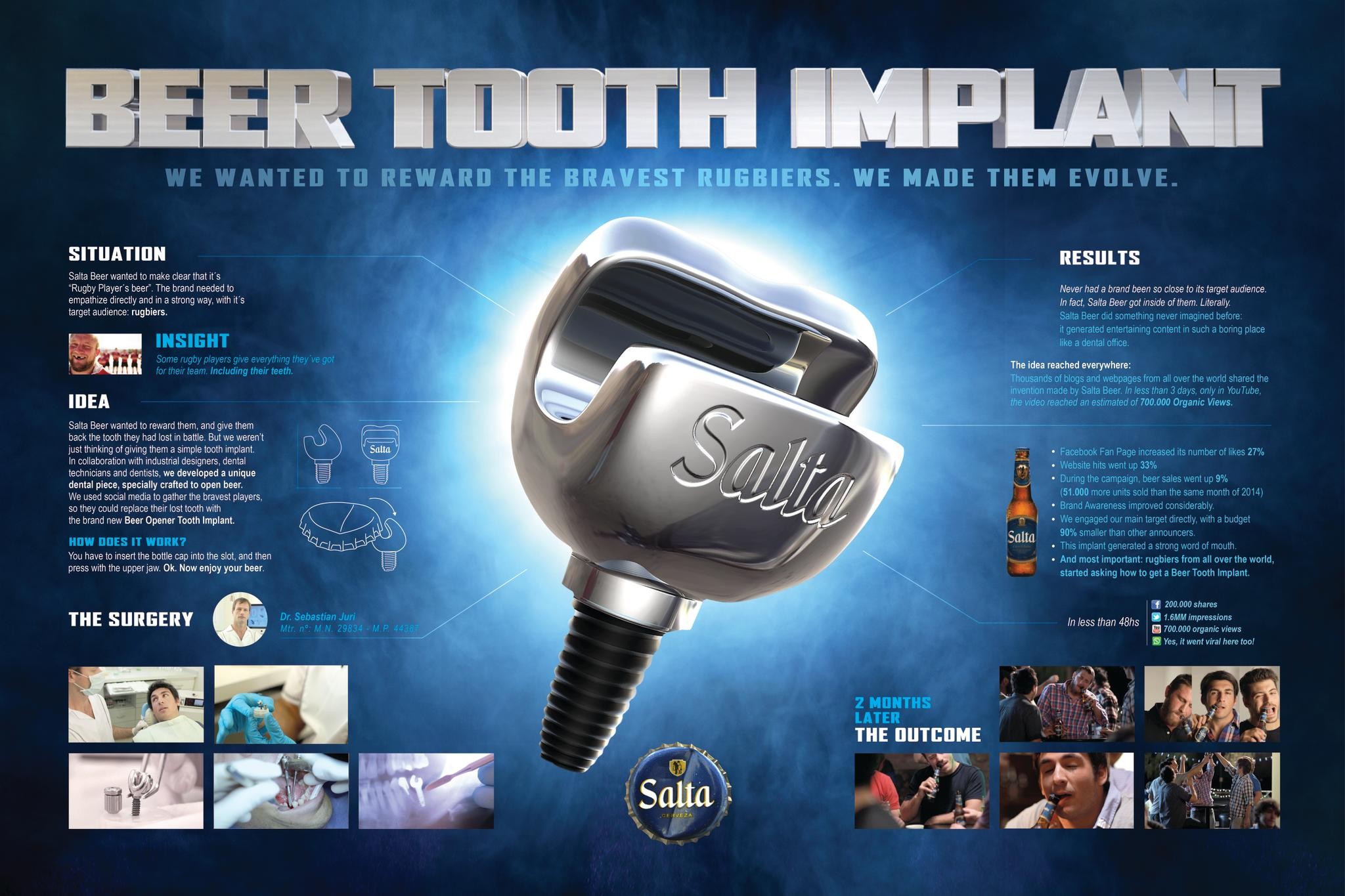 BEER TOOTH IMPLANT