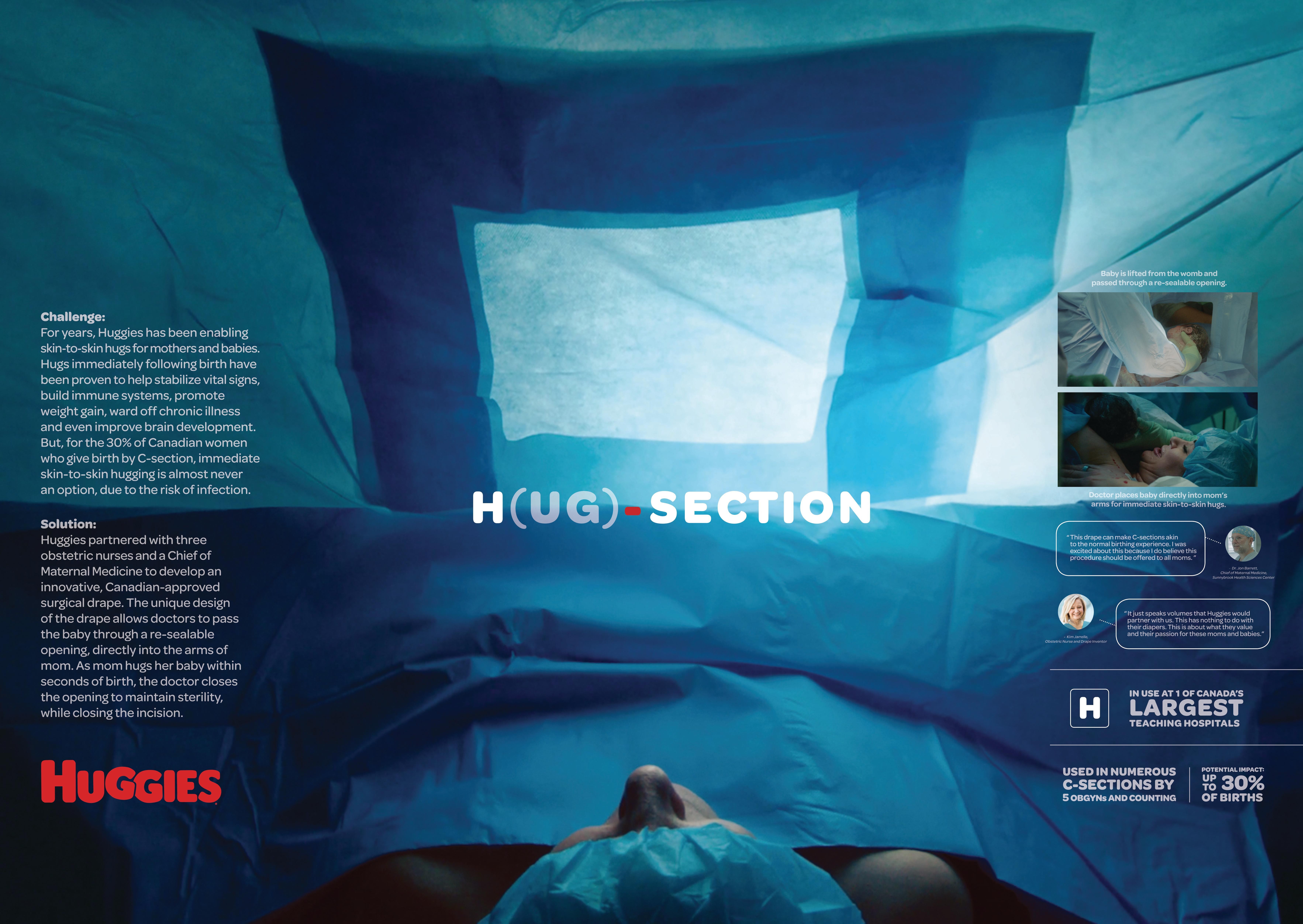 HUGGIES H-SECTION