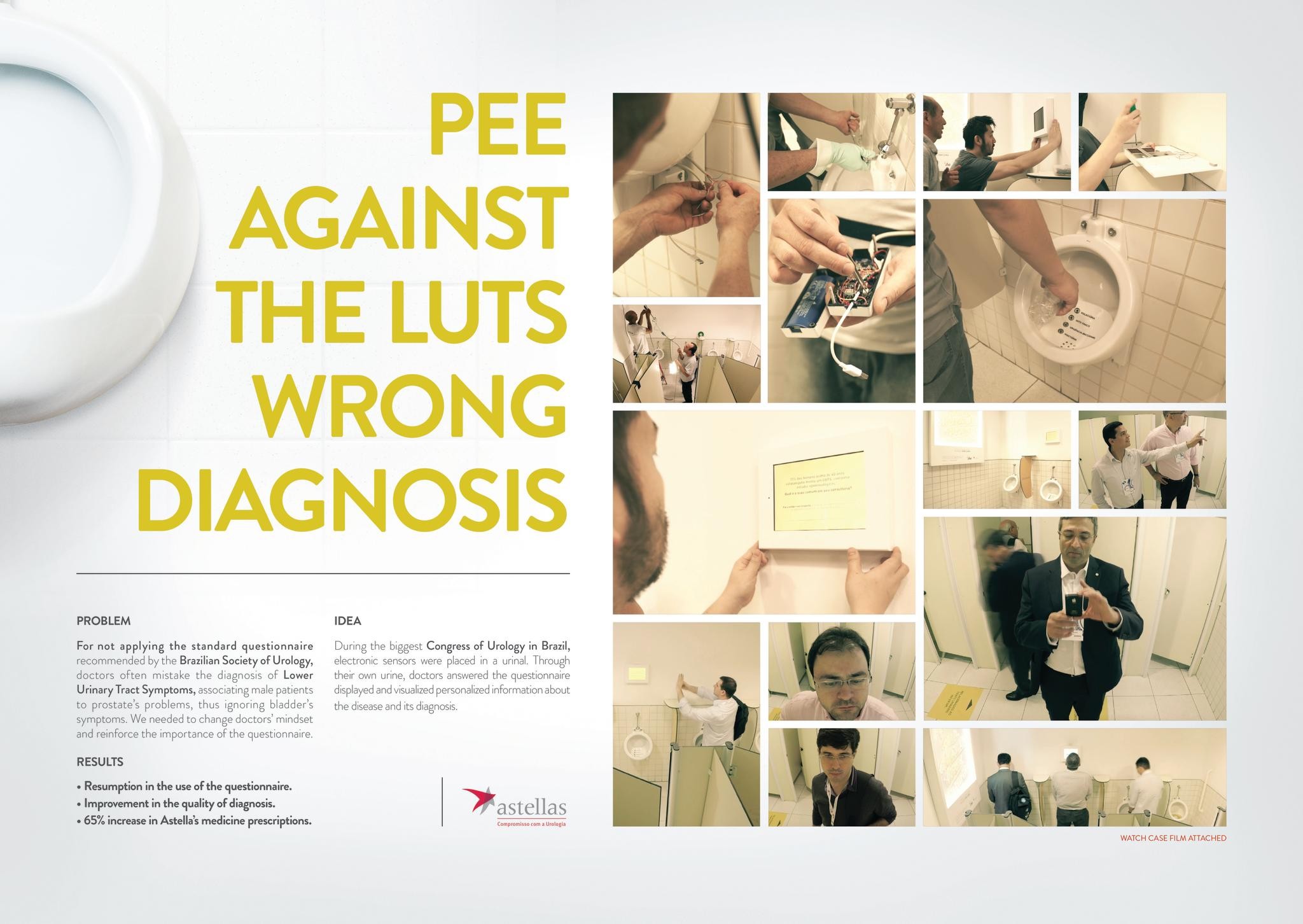 PEE AGAINST THE LUTS WRONG DIAGNOSIS