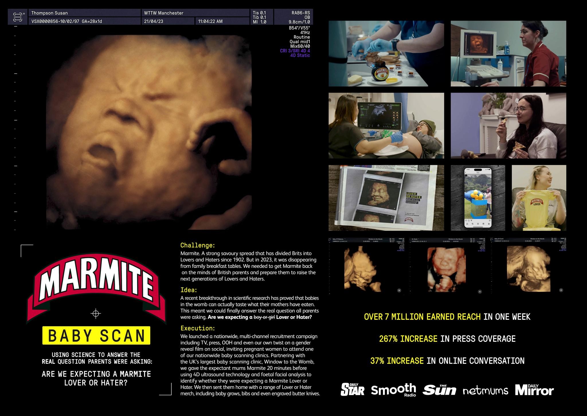 Marmite Baby Scan